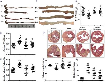 Curcumin Suppressed Activation of Dendritic Cells via JAK/STAT/SOCS Signal in Mice with Experimental Colitis